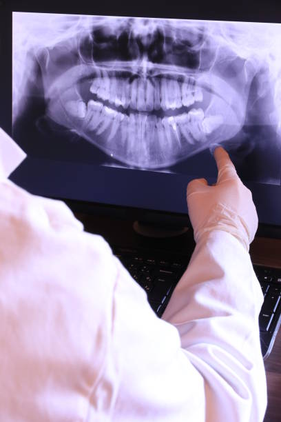 Best Emergency Denture Repair in Pion Hills, CA
